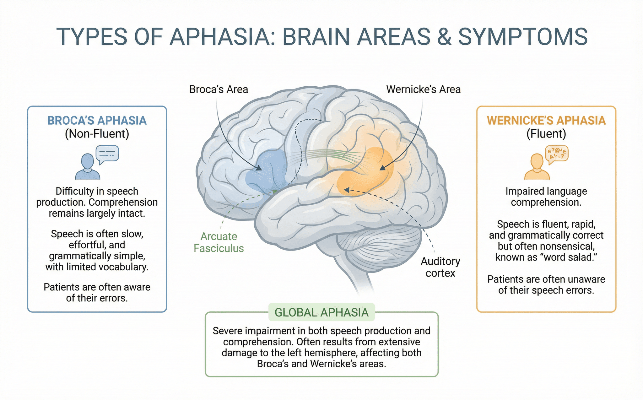 Diagram showing different types of aphasia and affected brain areas